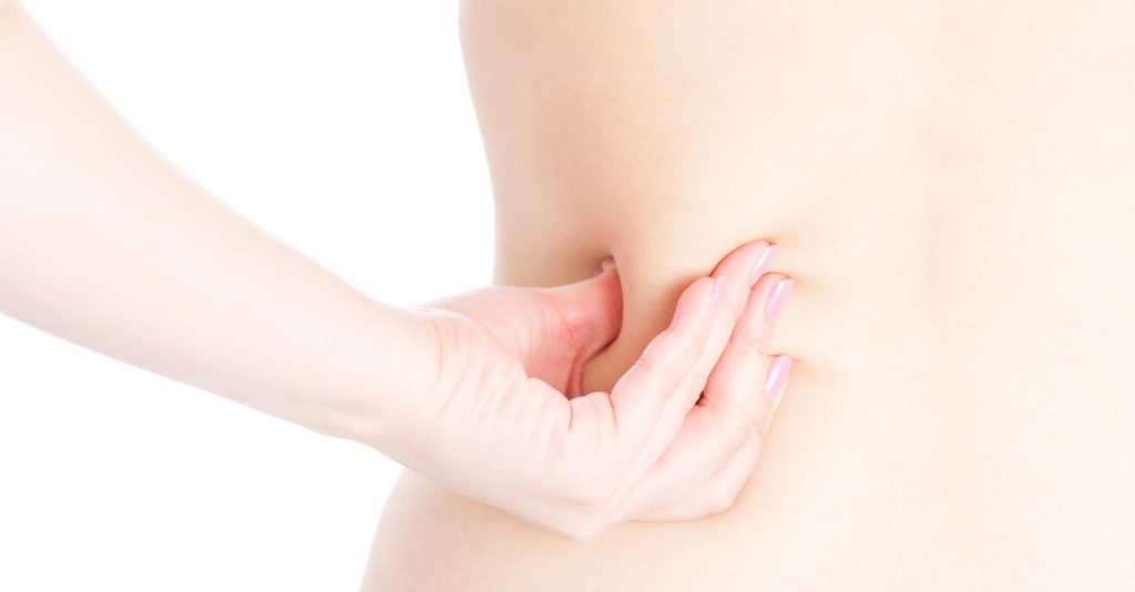 get rid of back fat SDCoolSculpting