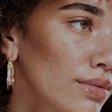 Close-up side portrait of a woman’s face highlighting natural skin texture and complexion